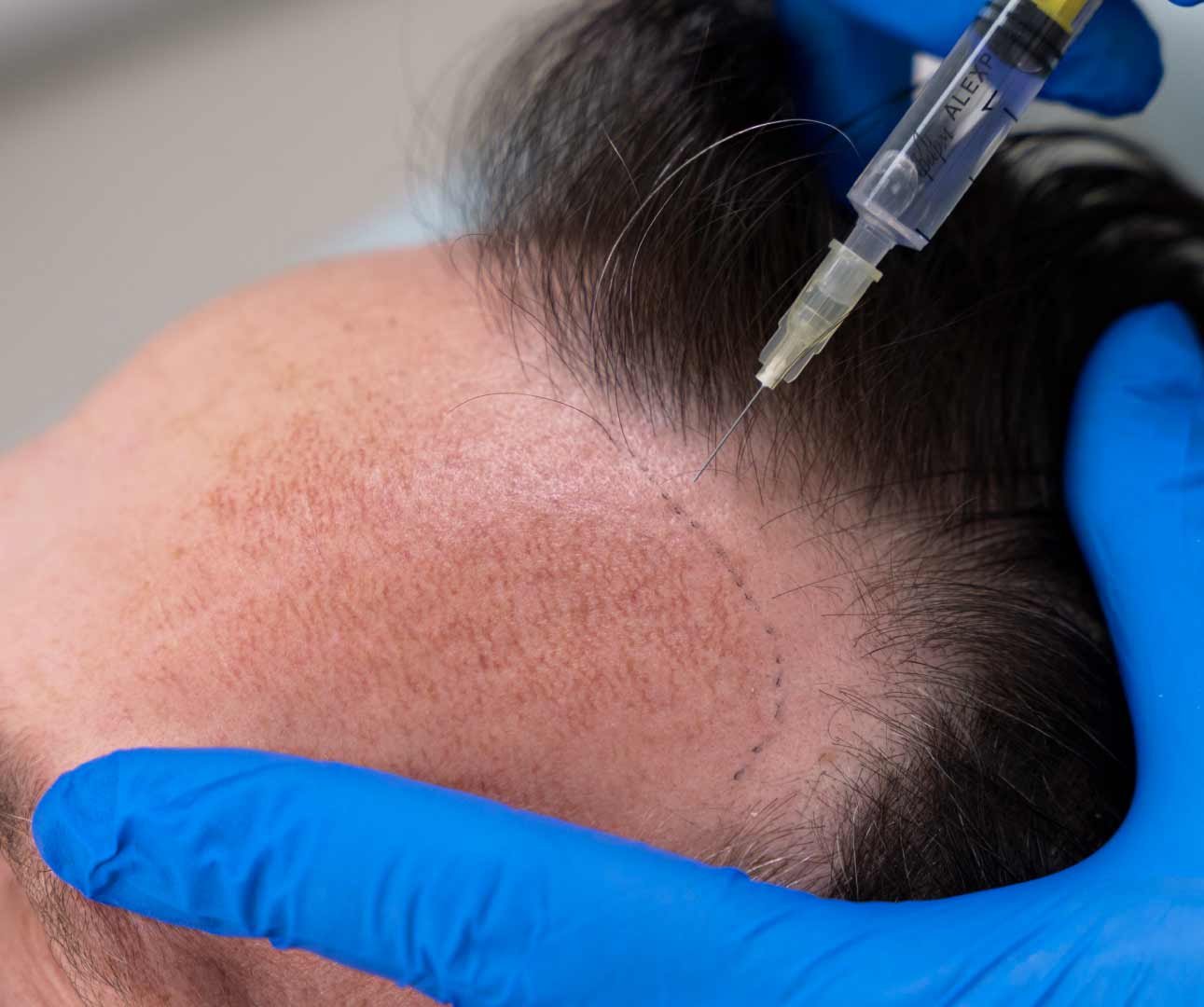 Medical Tourism Made Simple: Your Treatment Journey at SIMEDERA Clinic